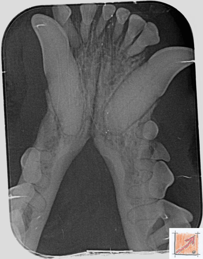 Chihuahua Mitralklappeninsuffizienz Trachealkollaps Chihuahua, Zahnfehlstellungen, BauFachForum, Baulexikon
