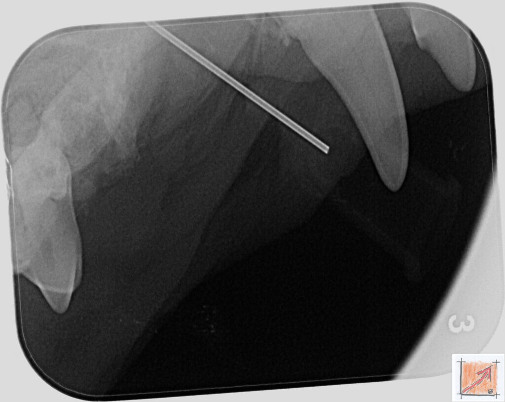 05 07 01 Chihuahua, Zahnfehlstellungen, BauFachForum, Baulexikon