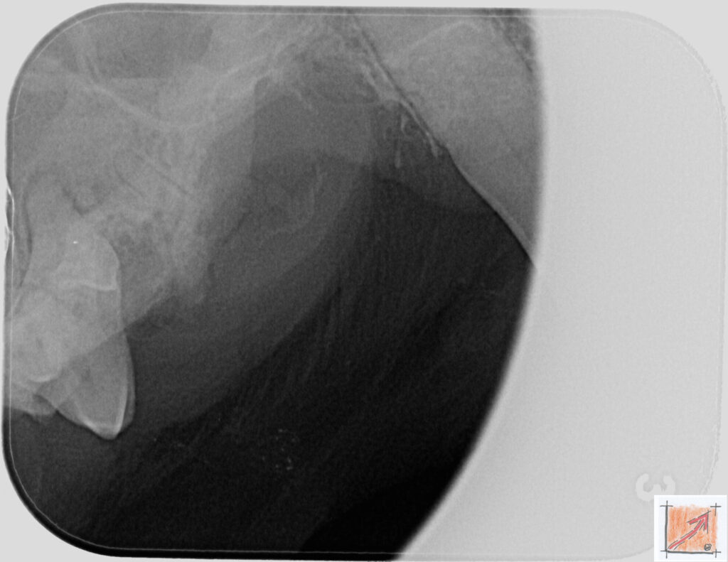 05 08 01 Chihuahua, Zahnfehlstellungen, BauFachForum, Baulexikon