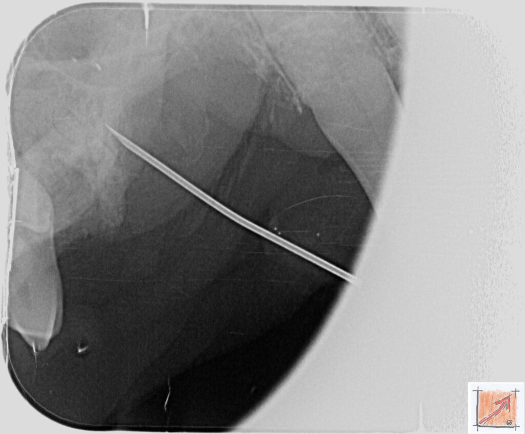 05 11 01 Chihuahua, Zahnfehlstellungen, BauFachForum, Baulexikon